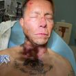 Image of Anthony Paredes with visible injuries to the face and neck, lying in a hospital setting. Image of Anthony Paredes with visible injuries to the face and neck, lying in a hospital setting.