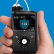 Image of a Medtronic MiniMed 630G insulin pump held in a hand, displaying its screen interface. Image of a Medtronic MiniMed 630G insulin pump held in a hand, displaying its screen interface.