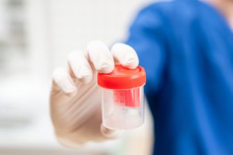 A person in gloves holding a urine sample container with a red lid.