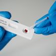A person in blue gloves using a pipette to apply a sample to a COVID-19 rapid test kit. A person in blue gloves using a pipette to apply a sample to a COVID-19 rapid test kit.
